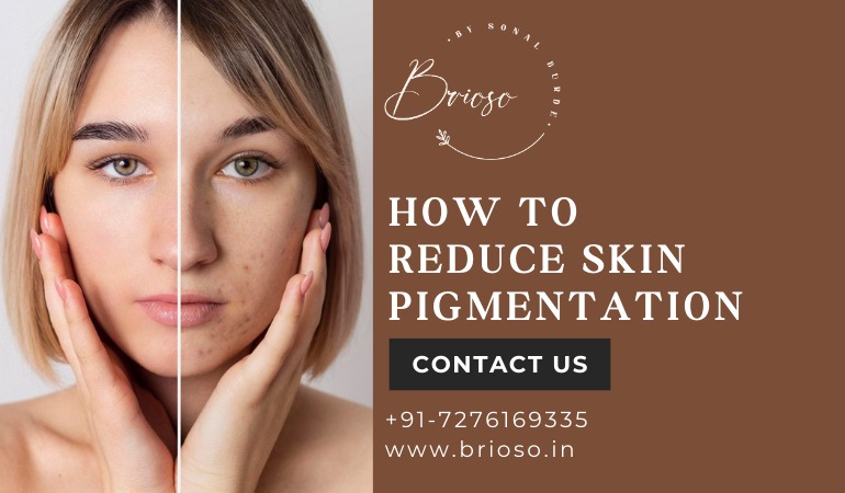 How to reduce skin pigmentation
